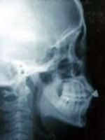 ふかつ歯科 睡眠歯科外来 レントゲン検査