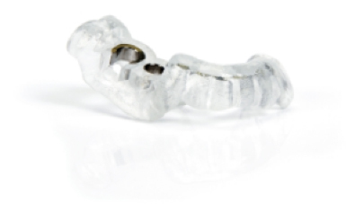 ふかつ歯科 シムプラント