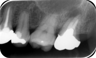 ふかつ歯科 レントゲン室
