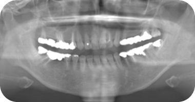 ふかつ歯科 レントゲン室
