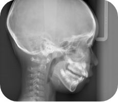 ふかつ歯科 レントゲン室