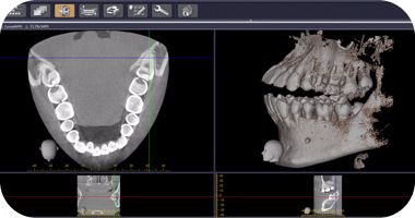 ふかつ歯科 レントゲン室